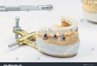 Dental technology stock photo