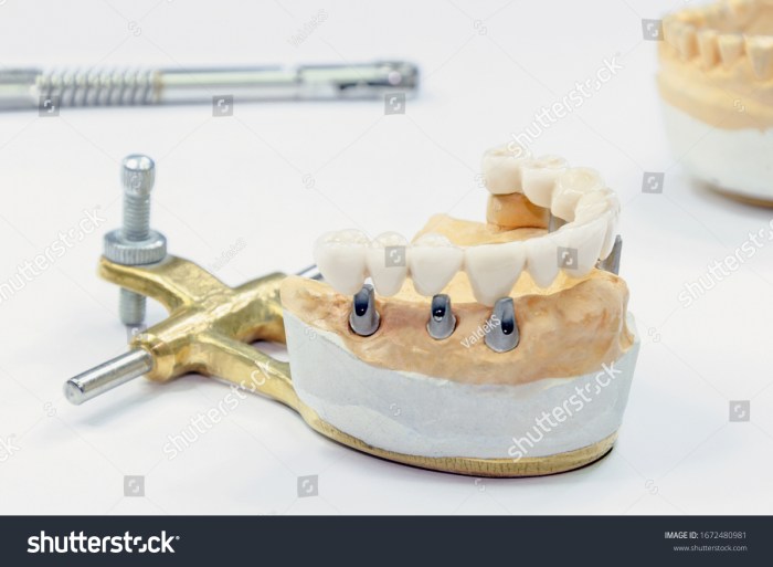 Dental technology stock photo